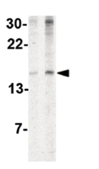 Western blot - Anti-IEX1/IER3 antibody (AB65152)
