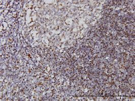 Immunohistochemistry (Formalin/PFA-fixed paraffin-embedded sections) - Anti-IFI16 antibody [2E3] (AB55328)