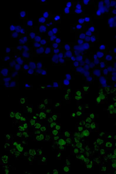Immunocytochemistry/ Immunofluorescence - Anti-IFI16 antibody [EPR11767(B)] (AB169788)