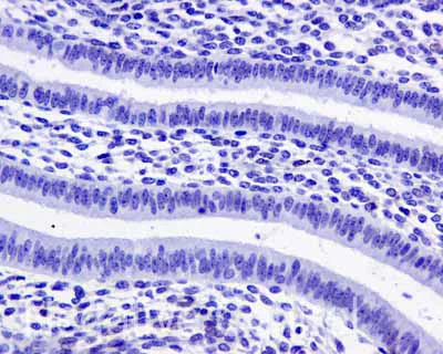 Immunohistochemistry (Formalin/PFA-fixed paraffin-embedded sections) - Anti-IFI16 antibody [EPR11767(B)] (AB169788)