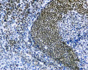 Immunohistochemistry (Formalin/PFA-fixed paraffin-embedded sections) - Anti-IFI16 antibody [EPR11767(B)] (AB169788)