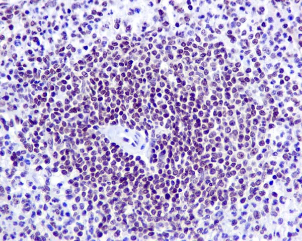 Immunohistochemistry (Formalin/PFA-fixed paraffin-embedded sections) - Anti-IFI16 antibody [EPR11767(B)] - BSA and Azide free (AB249529)