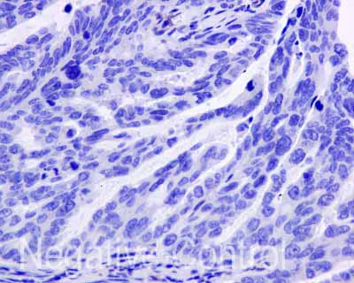Immunohistochemistry (Formalin/PFA-fixed paraffin-embedded sections) - Anti-IFI16 antibody [EPR11767(B)] - BSA and Azide free (AB249529)