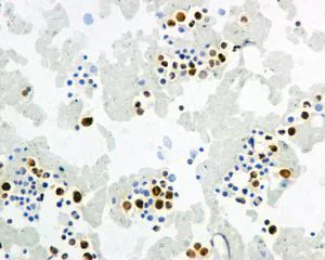 Immunohistochemistry (Formalin/PFA-fixed paraffin-embedded sections) - Anti-IFI16 antibody [EPR11767(B)] - BSA and Azide free (AB249529)