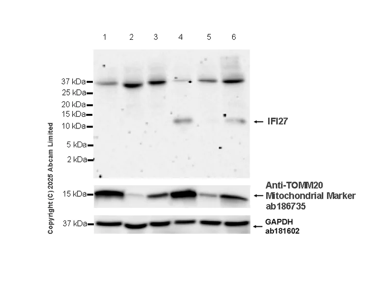Western blot - Anti-IFI27 antibody [EPR27275-176] (AB323852)