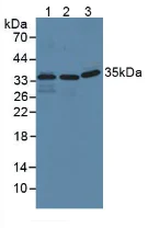 Western blot - Anti-IFI35 antibody (AB233415)