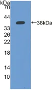 Western blot - Anti-IFI35 antibody (AB233415)