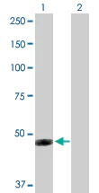 Western blot - Anti-IFI44 antibody (AB172499)
