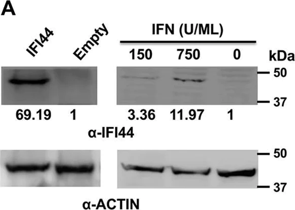 Western blot - Anti-IFI44 antibody (AB172499)