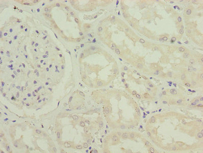 Immunohistochemistry (Formalin/PFA-fixed paraffin-embedded sections) - Anti-IFI44 antibody (AB236657), expandable thumbnail