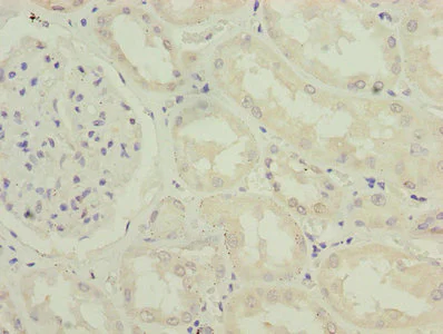 Immunohistochemistry (Formalin/PFA-fixed paraffin-embedded sections) - Anti-IFI44 antibody (AB236657)