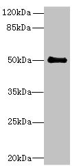 Western blot - Anti-IFI44 antibody (AB236657), expandable thumbnail