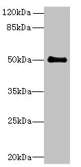 Western blot - Anti-IFI44 antibody (AB236657)