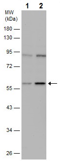 Western blot - Anti-IFIT1 antibody (AB229083), expandable thumbnail