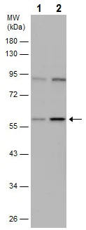 Western blot - Anti-IFIT1 antibody (AB229083)