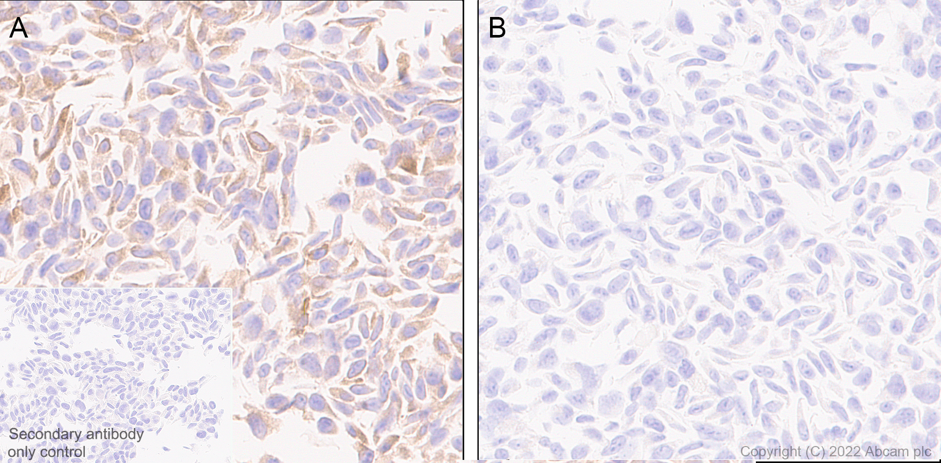Immunohistochemistry (Formalin/PFA-fixed paraffin-embedded sections) - Anti-IFIT1 antibody [EPR27276-63] (BSA and Azide free) (AB305302), expandable thumbnail
