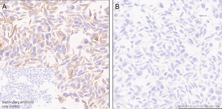 Immunohistochemistry (Formalin/PFA-fixed paraffin-embedded sections) - Anti-IFIT1 antibody [EPR27276-63] (BSA and Azide free) (AB305302)