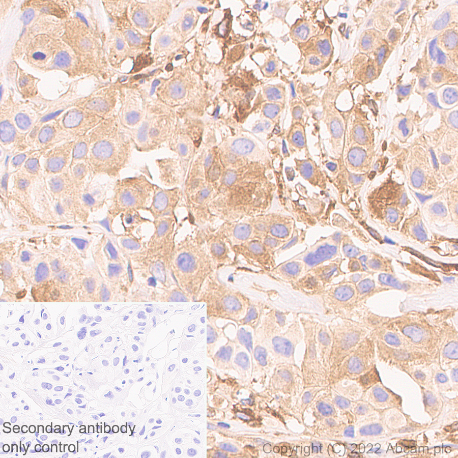 Immunohistochemistry (Formalin/PFA-fixed paraffin-embedded sections) - Anti-IFIT1 antibody [EPR27276-63] (BSA and Azide free) (AB305302), expandable thumbnail