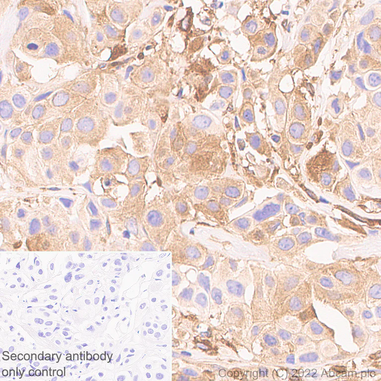 Immunohistochemistry (Formalin/PFA-fixed paraffin-embedded sections) - Anti-IFIT1 antibody [EPR27276-63] (BSA and Azide free) (AB305302)