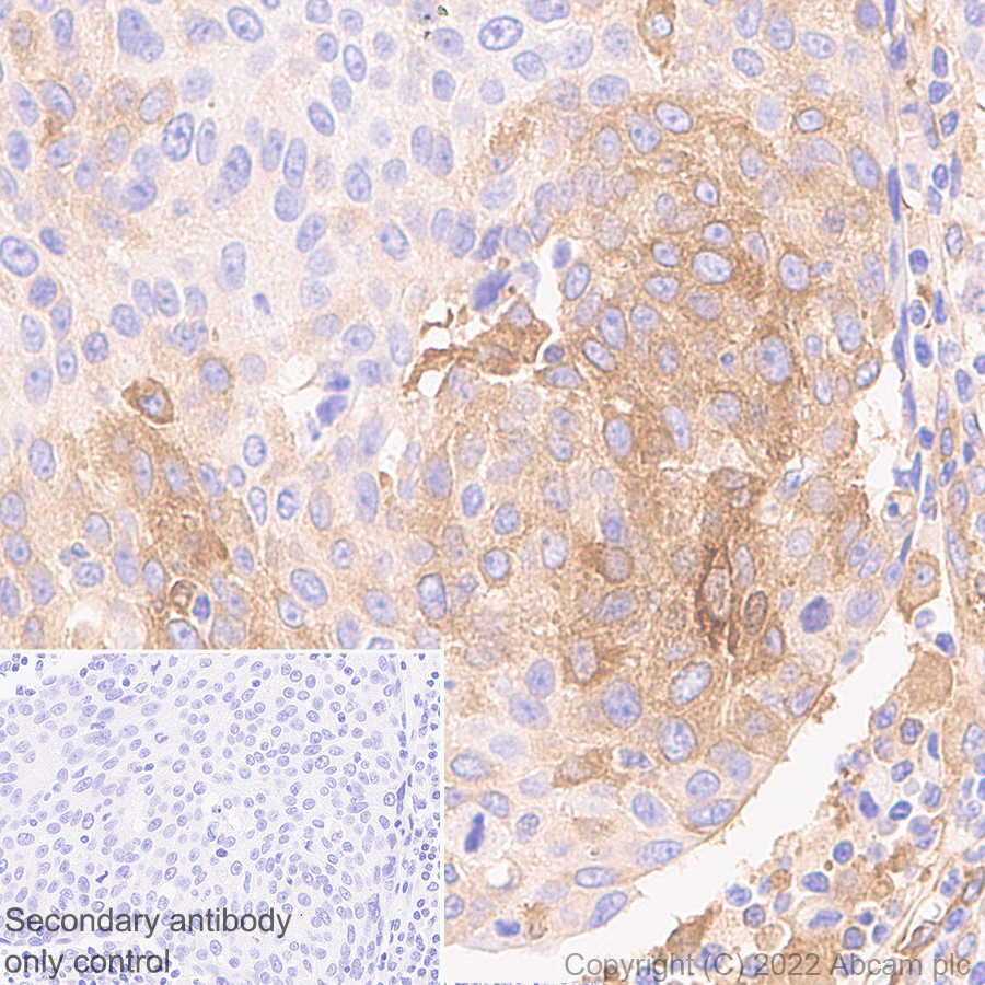 Immunohistochemistry (Formalin/PFA-fixed paraffin-embedded sections) - Anti-IFIT1 antibody [EPR27276-63] (BSA and Azide free) (ab305302), expandable thumbnail