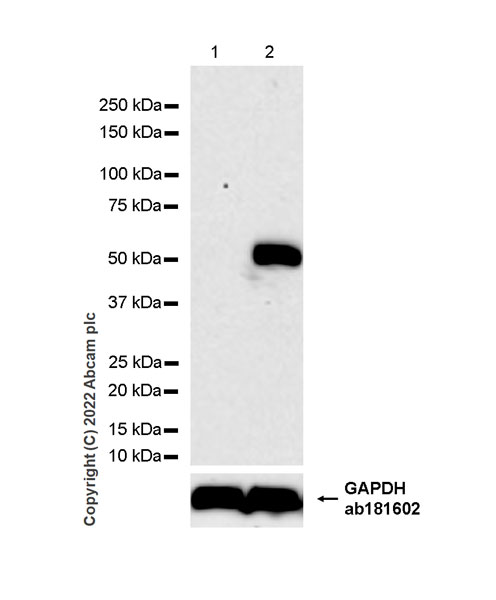 Western blot - Anti-IFIT1 antibody [EPR27276-63] (BSA and Azide free) (ab305302), expandable thumbnail