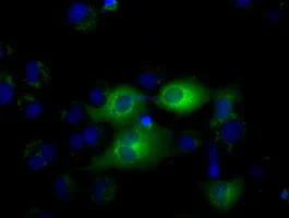 Immunocytochemistry/ Immunofluorescence - Anti-IFIT1 antibody [OTI3G8] (AB118062)