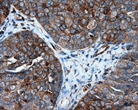 Immunohistochemistry (Formalin/PFA-fixed paraffin-embedded sections) - Anti-IFIT1 antibody [OTI3G8] (AB118062)
