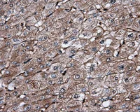 Immunohistochemistry (Formalin/PFA-fixed paraffin-embedded sections) - Anti-IFIT1 antibody [OTI3G8] (AB118062)