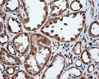 Immunohistochemistry (Formalin/PFA-fixed paraffin-embedded sections) - Anti-IFIT1 antibody [OTI3G8] (AB118062)