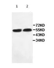 Western blot - Anti-IFIT2 antibody (AB113112)