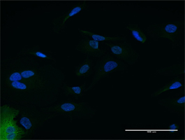 Immunocytochemistry/ Immunofluorescence - Anti-IFIT2 antibody (AB168407), expandable thumbnail