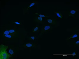 Immunocytochemistry/ Immunofluorescence - Anti-IFIT2 antibody (AB168407)