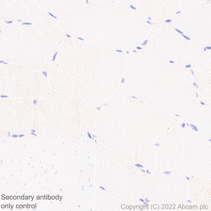 Immunohistochemistry (Formalin/PFA-fixed paraffin-embedded sections) - Anti-IFIT2 antibody [EPR26404-119] (AB305231)