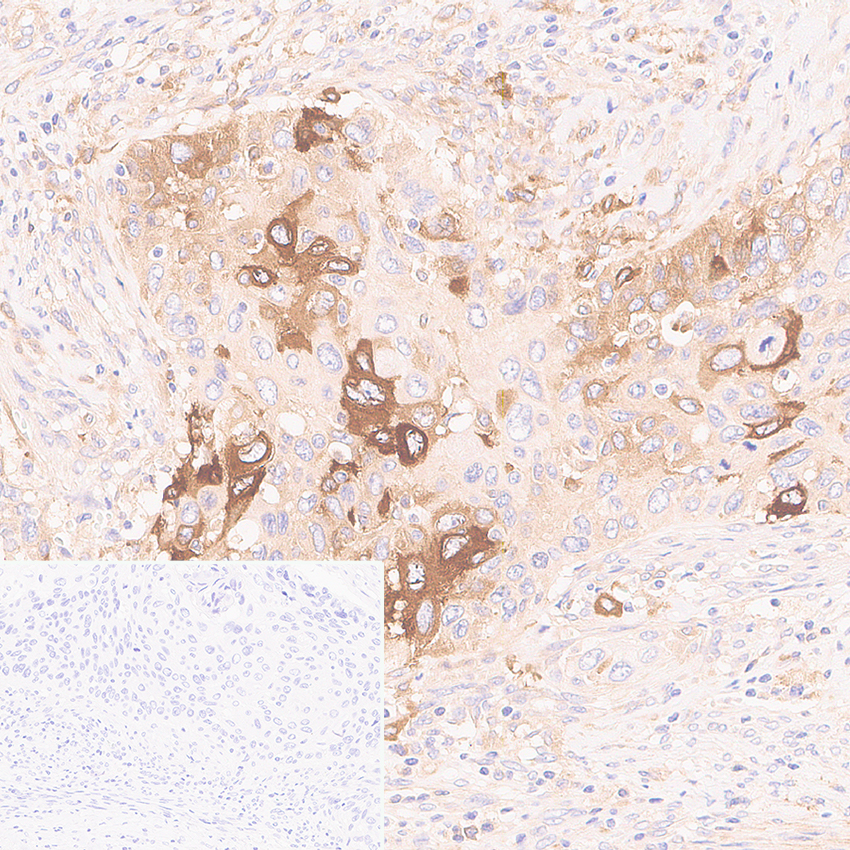 Immunohistochemistry (Formalin/PFA-fixed paraffin-embedded sections) - Anti-IFIT2 antibody [EPR26404-119] - BSA and Azide free (AB305232), expandable thumbnail