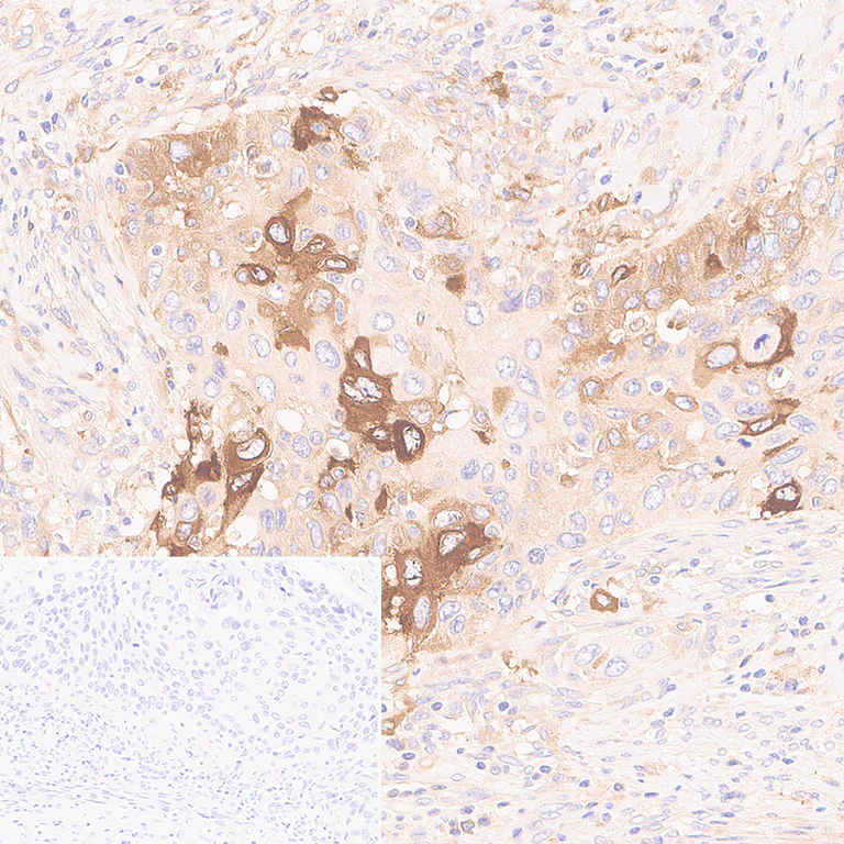 Immunohistochemistry (Formalin/PFA-fixed paraffin-embedded sections) - Anti-IFIT2 antibody [EPR26404-119] - BSA and Azide free (AB305232)
