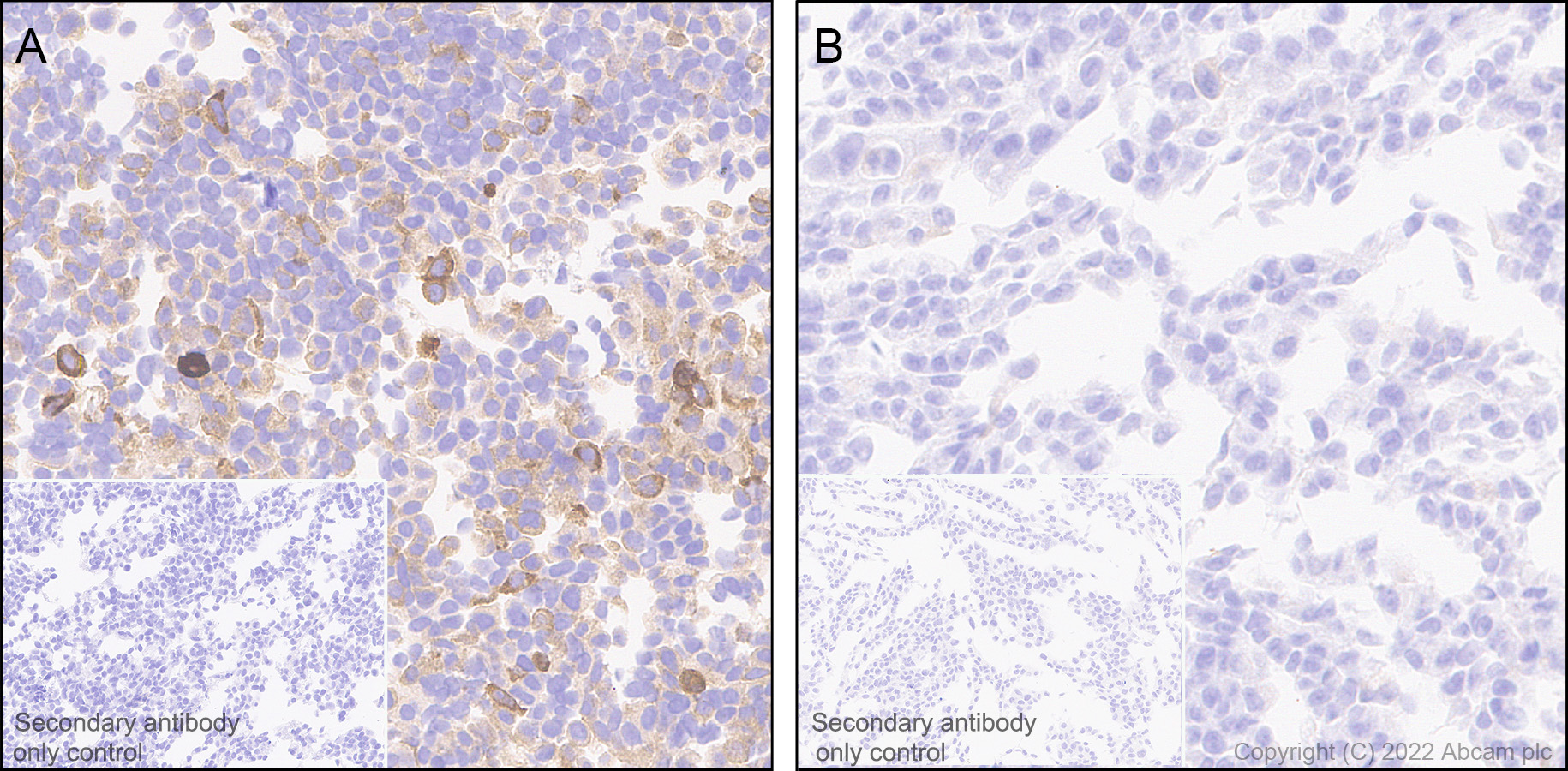 Immunohistochemistry (Formalin/PFA-fixed paraffin-embedded sections) - Anti-IFIT2 antibody [EPR26404-119] - BSA and Azide free (AB305232), expandable thumbnail
