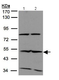 Western blot - Anti-IFIT2 antibody - N-terminal (AB154487)