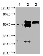 Immunoprecipitation - Anti-IFIT3/P60 antibody (AB236243)
