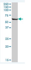 Western blot - Anti-IFIT3/P60 antibody (AB76818), expandable thumbnail
