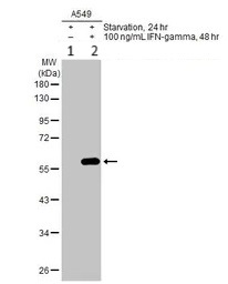 Western blot - Anti-IFIT3/P60 antibody (AB95989)