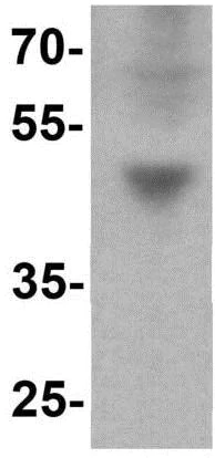 Western blot - Anti-IFIT3/P60 antibody - C-terminal (AB191689)