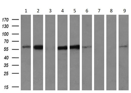 Western blot - Anti-IFIT3/P60 antibody [OTI1G1] (AB118045)