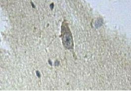 Immunohistochemistry (Formalin/PFA-fixed paraffin-embedded sections) - Anti-IFIT5 antibody (AB113485)