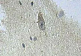 Immunohistochemistry (Formalin/PFA-fixed paraffin-embedded sections) - Anti-IFIT5 antibody (AB113485)