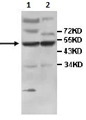Western blot - Anti-IFIT5 antibody (AB113485)