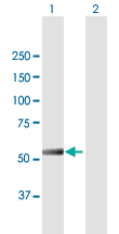 Western blot - Anti-IFIT5 antibody (AB167272)