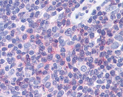 Immunohistochemistry (Formalin/PFA-fixed paraffin-embedded sections) - Anti-IFITM1 antibody (AB117519)