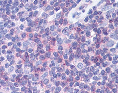 Immunohistochemistry (Formalin/PFA-fixed paraffin-embedded sections) - Anti-IFITM1 antibody (AB117519)