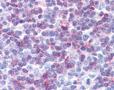 Immunohistochemistry (Formalin/PFA-fixed paraffin-embedded sections) - Anti-IFITM1 antibody (AB117519)