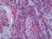 Immunohistochemistry (Formalin/PFA-fixed paraffin-embedded sections) - Anti-IFITM1 antibody (AB117533), expandable thumbnail